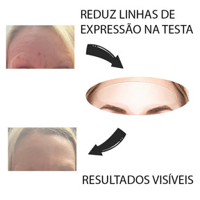 NaturaVitta - Livre de rugas e linhas de expressões